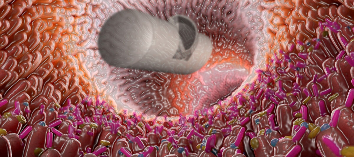 Concept image of a robotic pill entering the gut